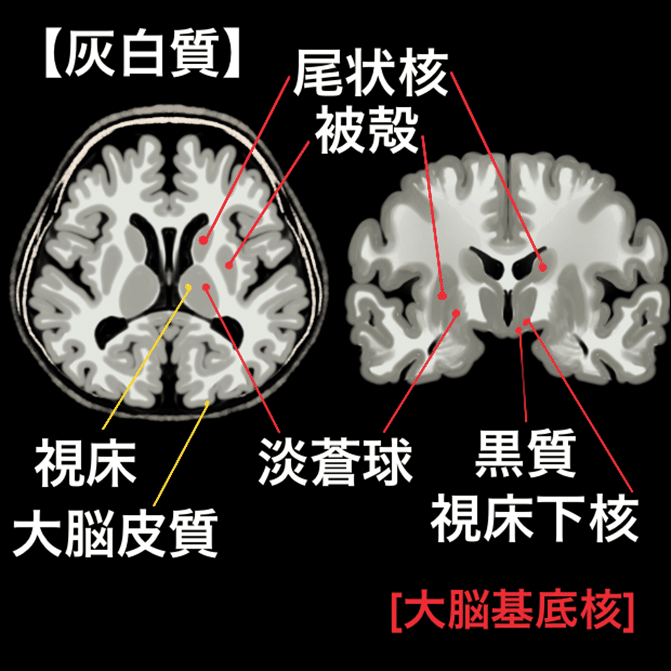 頭部解剖 読影 Mri認定試験対策ノート Note