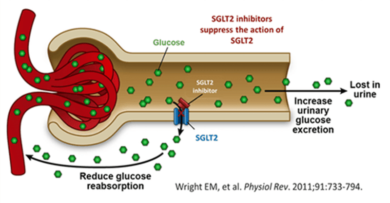 臨床工学技士がsglt2を勉強してみた 伊藤 朋晃 Tomoaki Ito Note