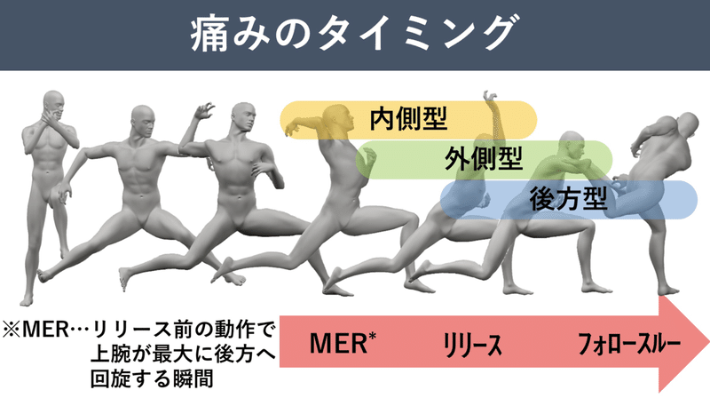 投球障害：肩・肘の障害予防 DVD 投球肩／投球障害～ゼロポジション保持機能に着目して～【DVD2枚