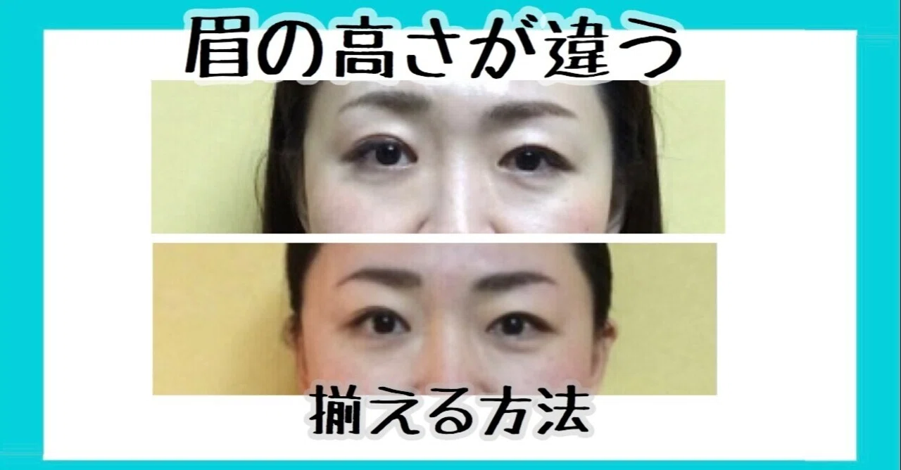 眉の高さが左右違うなおす方法 マッサージと体操のやり方 お顔の整体師 戸塚哲春 Note
