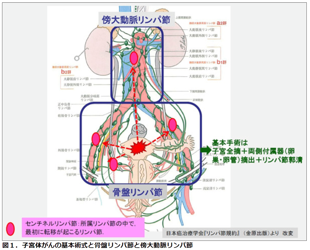 ロボット支援下 腹腔鏡下子宮悪性腫瘍手術 -work.07-|Yama ロボット支援下 腹腔鏡下子宮悪性腫瘍手術 -work.07-|Yama
