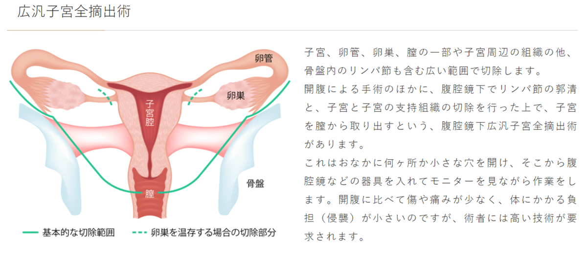 ロボット支援下 腹腔鏡下子宮悪性腫瘍手術 -work.07-|Yama ロボット支援下 腹腔鏡下子宮悪性腫瘍手術 -work.07-|Yama