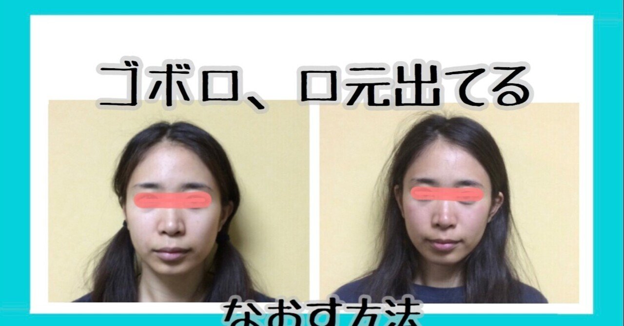 口ゴボ 口元出てる引っ込めるトレーニング方法 お顔の整体師 戸塚哲春 Note 口ゴボ 口元出てる引っ込めるトレーニング方法 お顔の整体師 戸塚哲春 Note