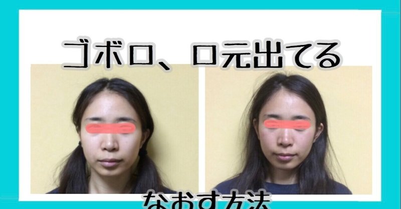 口ゴボ 口元出てる引っ込めるトレーニング方法 お顔の整体師 戸塚哲春 Note 口ゴボ 口元出てる引っ込めるトレーニング方法 お顔の整体師 戸塚哲春 Note