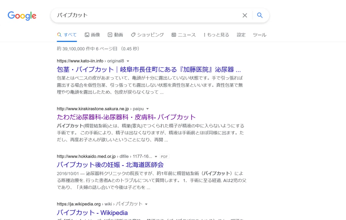 ”パイプカット”の検索結果