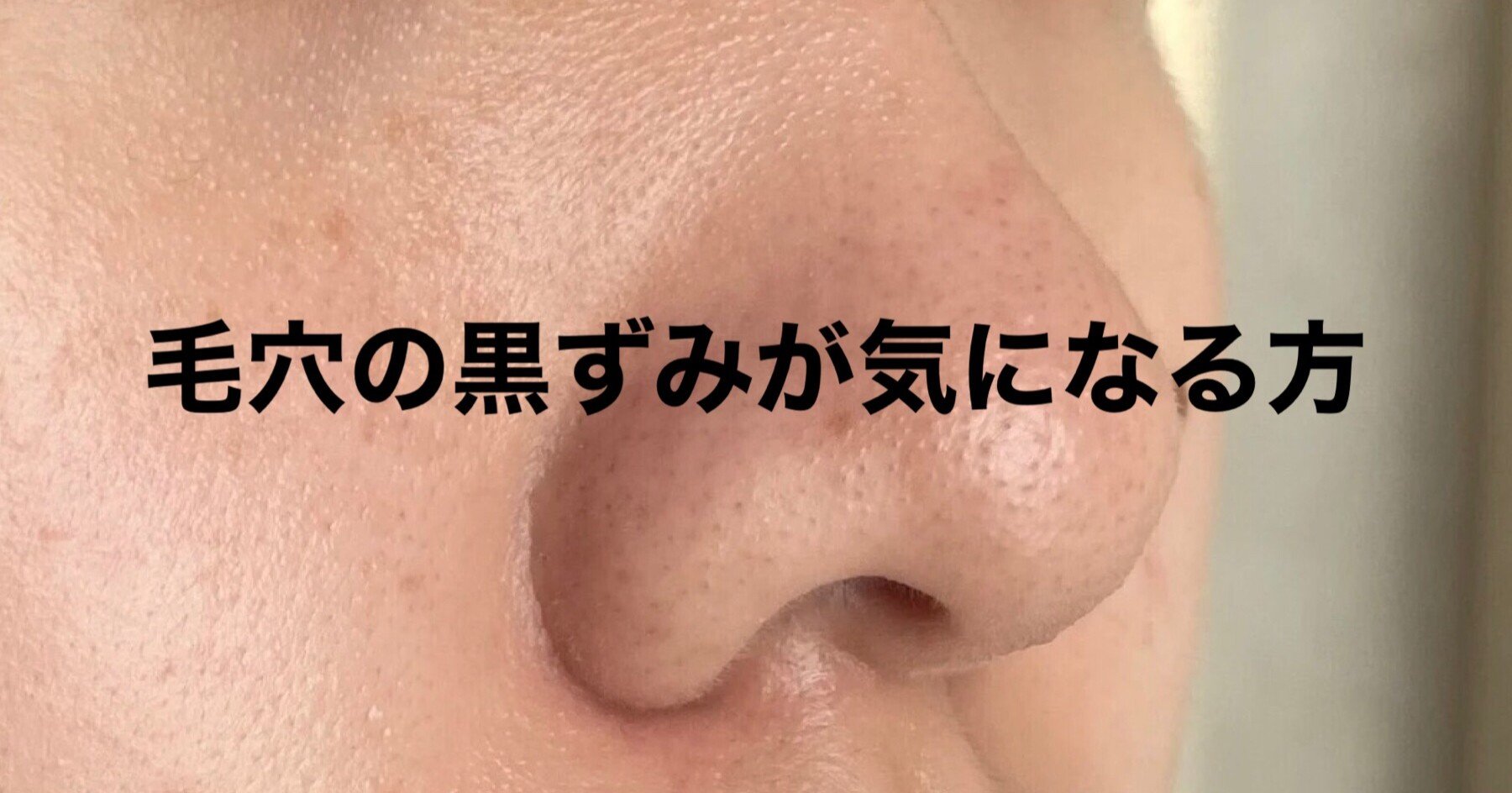 毛穴の黒ずみにベビーオイル洗顔 毛穴バランスリセット法を実施している方 つば エクストラクションの人 Note