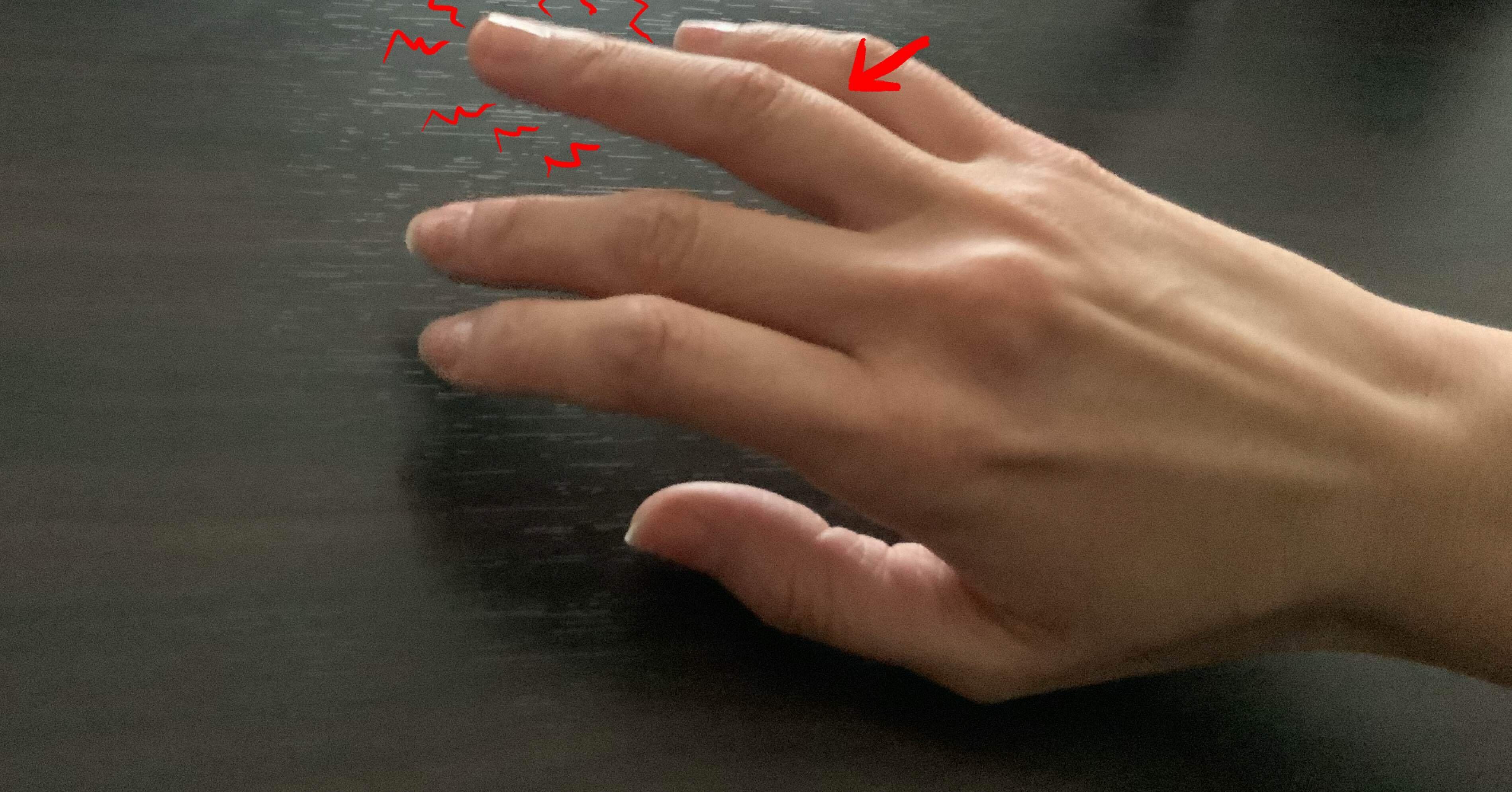 右手の薬指がめっちゃ痛い ズキズキする Kamio Note 右手の薬指がめっちゃ痛い ズキズキする Kamio Note