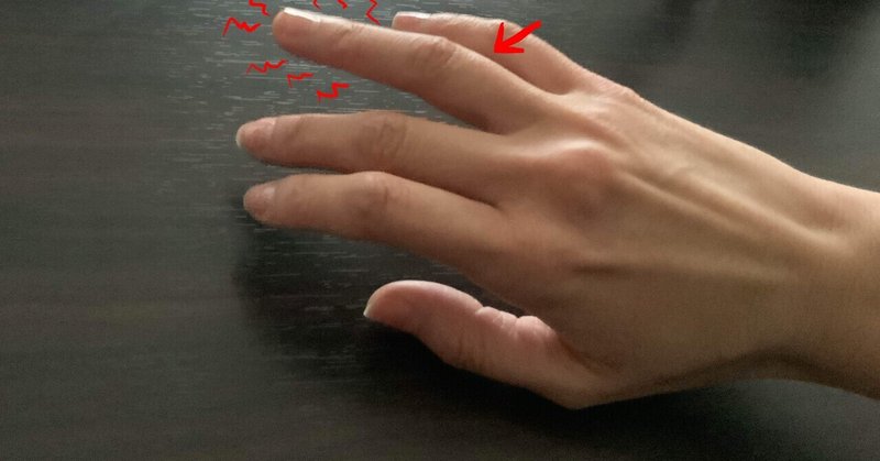 右手の薬指がめっちゃ痛い ズキズキする Kamio Note