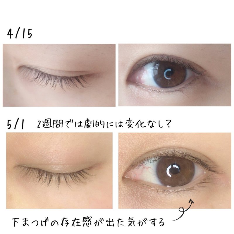 ルミガンでまつ毛ふさふさになるか検証してみる その2 すもも Note ルミガンでまつ毛ふさふさになるか検証してみる その2 すもも Note