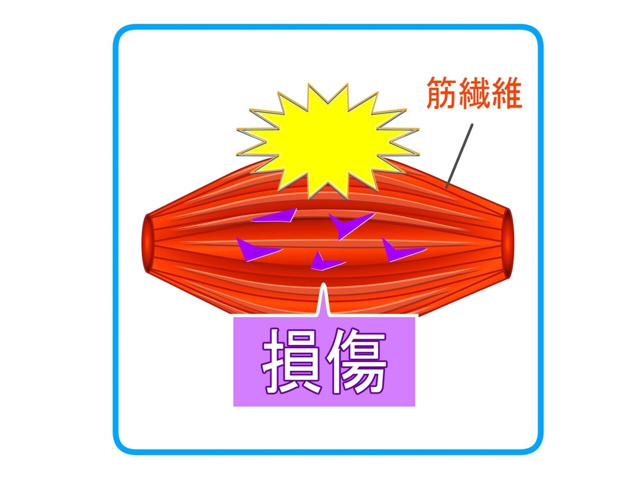 筋肉 損傷