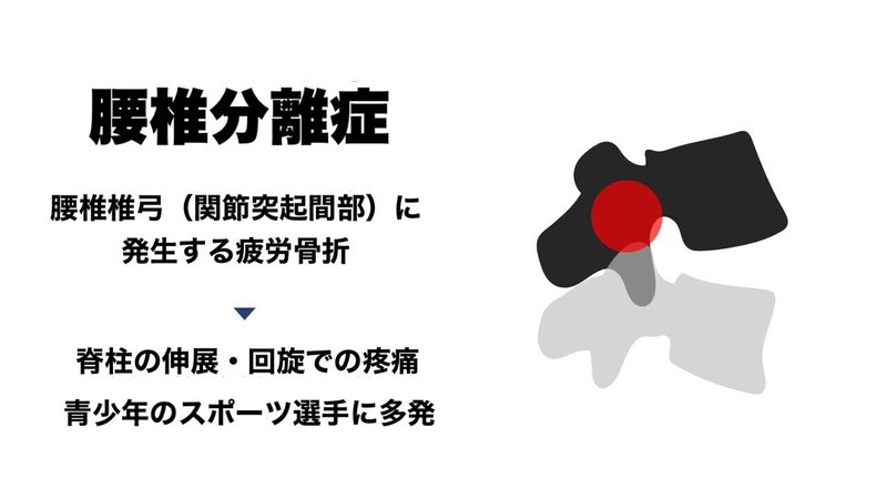 腰椎分離症 評価 L Fit Note 腰椎分離症 評価 L Fit Note