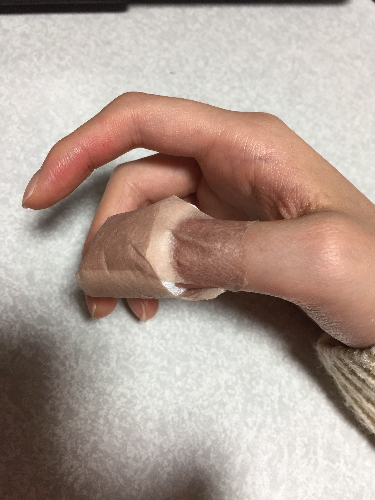 会社の棚に指を挟んで 怪我してしまいました 痛さに耐えられなくて 定時後に病院へ 骨は折れてなかったんですが 内出血がひどく 爪に穴を開けて血 を抜きました うぅ っ W C 痛いよぉ リンス アクション4コマ漫画 Note 会社の棚に指を挟んで 怪我してしまいました 痛さに耐えられなくて 定時後に病院へ 骨は折れてなかったんですが 内出血がひどく 爪に穴を開けて血 を抜きました うぅ っ W C 痛いよぉ リンス アクション4コマ漫画 Note