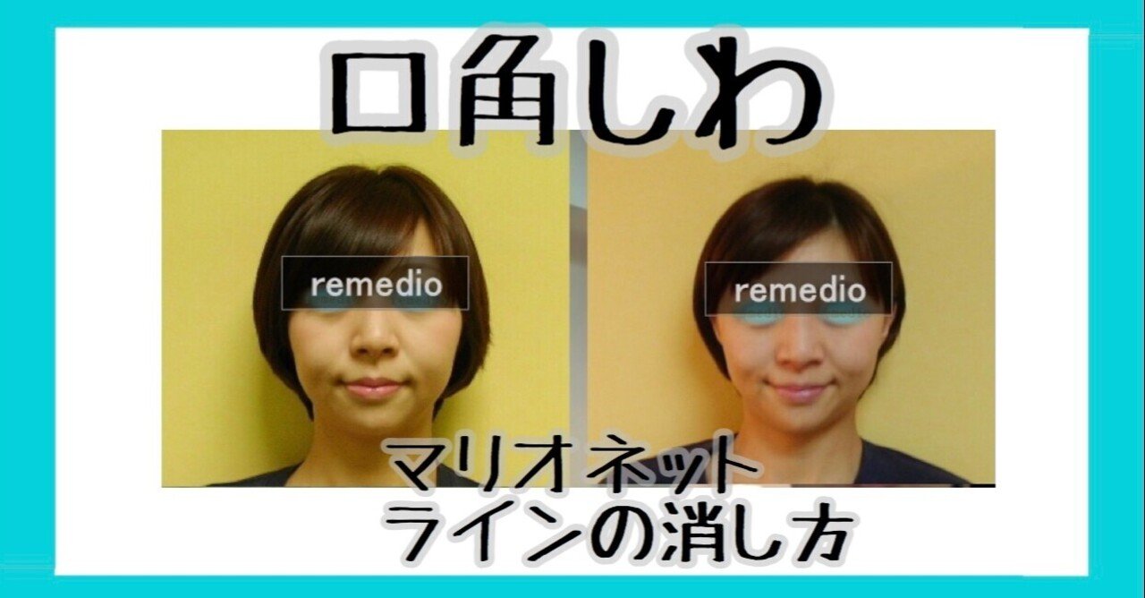 口角シワ マリオネットラインの消し方 お顔の整体師 戸塚哲春 Note