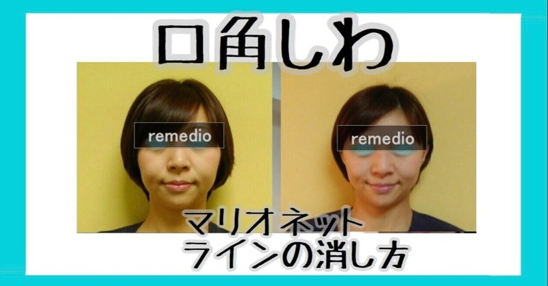 口角シワ マリオネットラインの消し方 お顔の整体師 戸塚哲春 Note 口角シワ マリオネットラインの消し方 お顔の整体師 戸塚哲春 Note