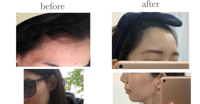 肌断食の効果 の新着タグ記事一覧 Note つくる つながる とどける