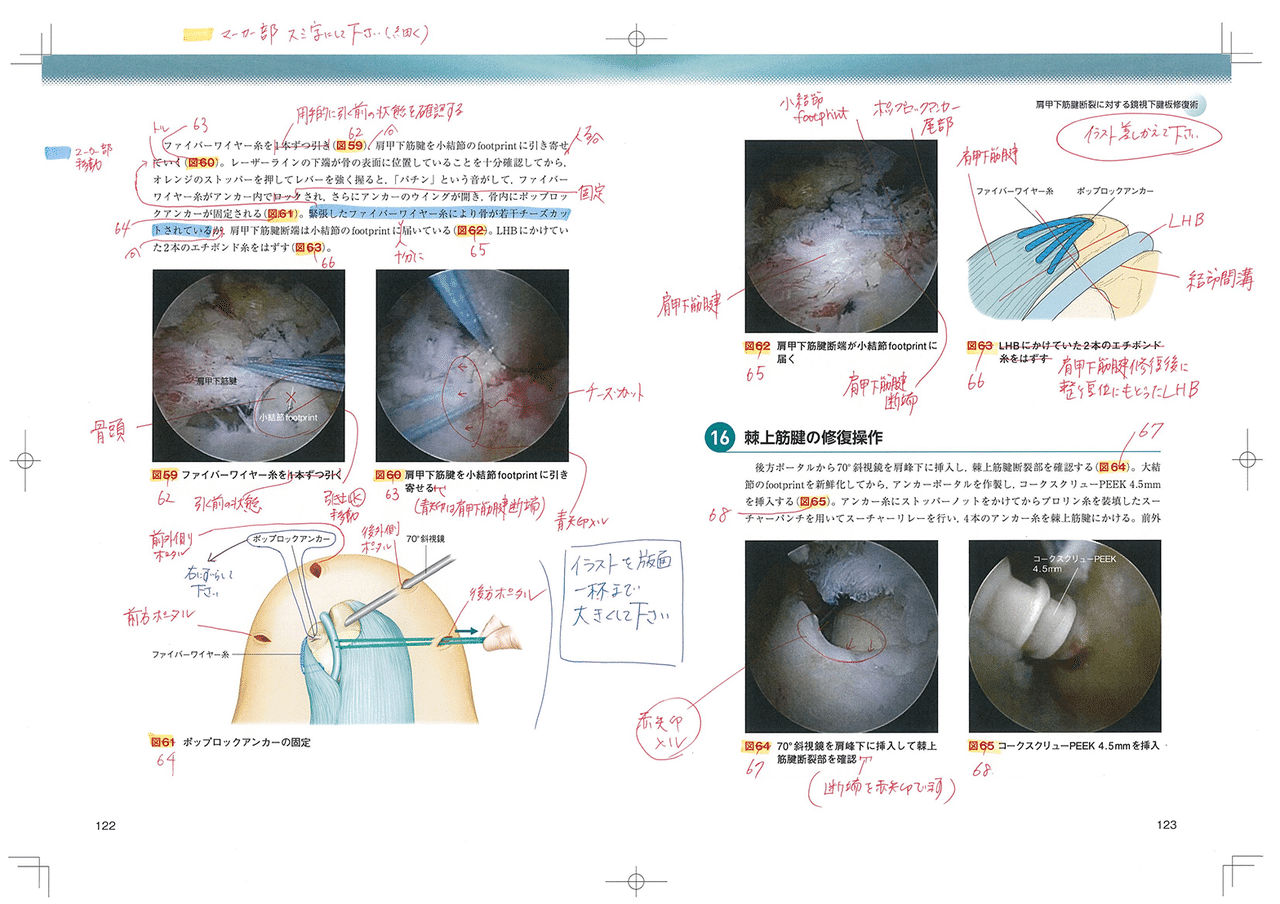 改訂第2版 ゼロからマスター 肩の鏡視下手術』|メジカルビュー社 改訂第2版 ゼロからマスター 肩の鏡視下手術』|メジカルビュー社