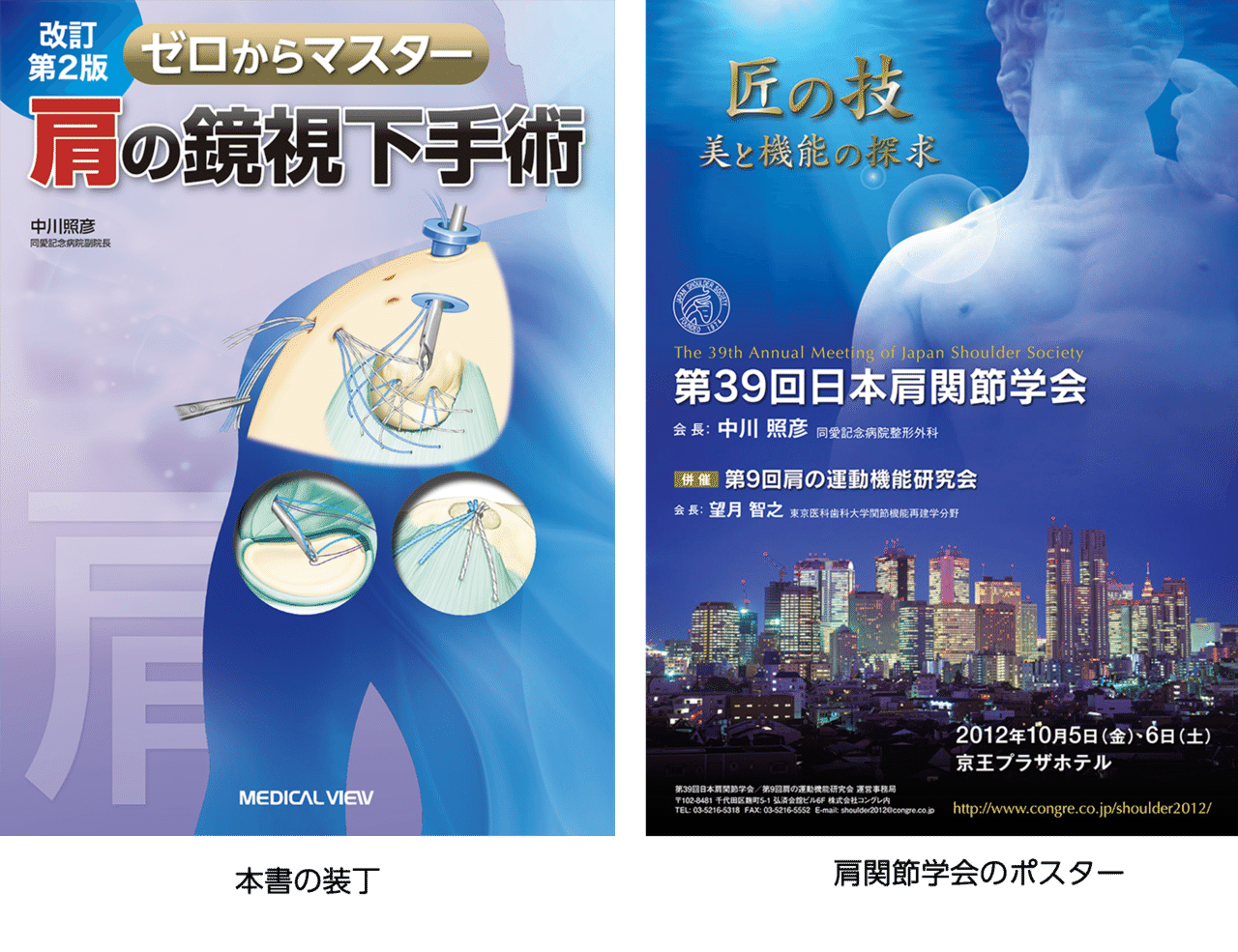改訂第2版 ゼロからマスター 肩の鏡視下手術』|メジカルビュー社 改訂第2版 ゼロからマスター 肩の鏡視下手術』|メジカルビュー社