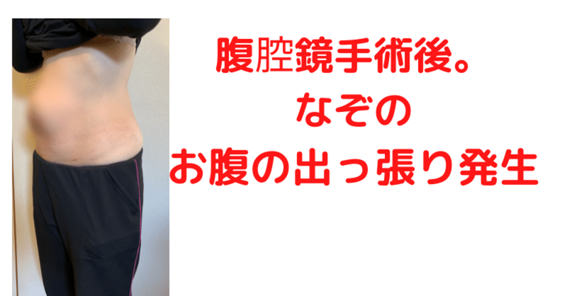 子宮筋腫 お腹 写真 高校生 子宮筋腫 お腹 写真 Sabrinasharrowjp 子宮筋腫 お腹 写真 高校生 子宮筋腫 お腹 写真 Sabrinasharrowjp