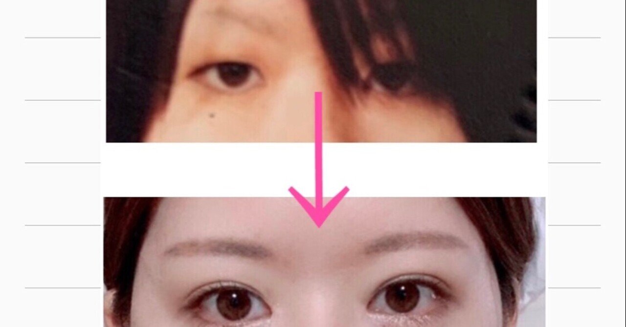 目頭切開」の新着タグ記事一覧｜note u2015u2015つくる、つながる、とどける。