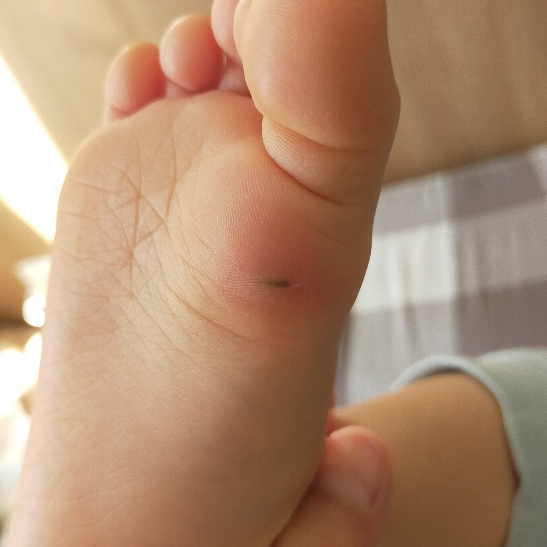 こどもにトゲが刺さった 大泣きで取らせてくれない 対処法 さと Note