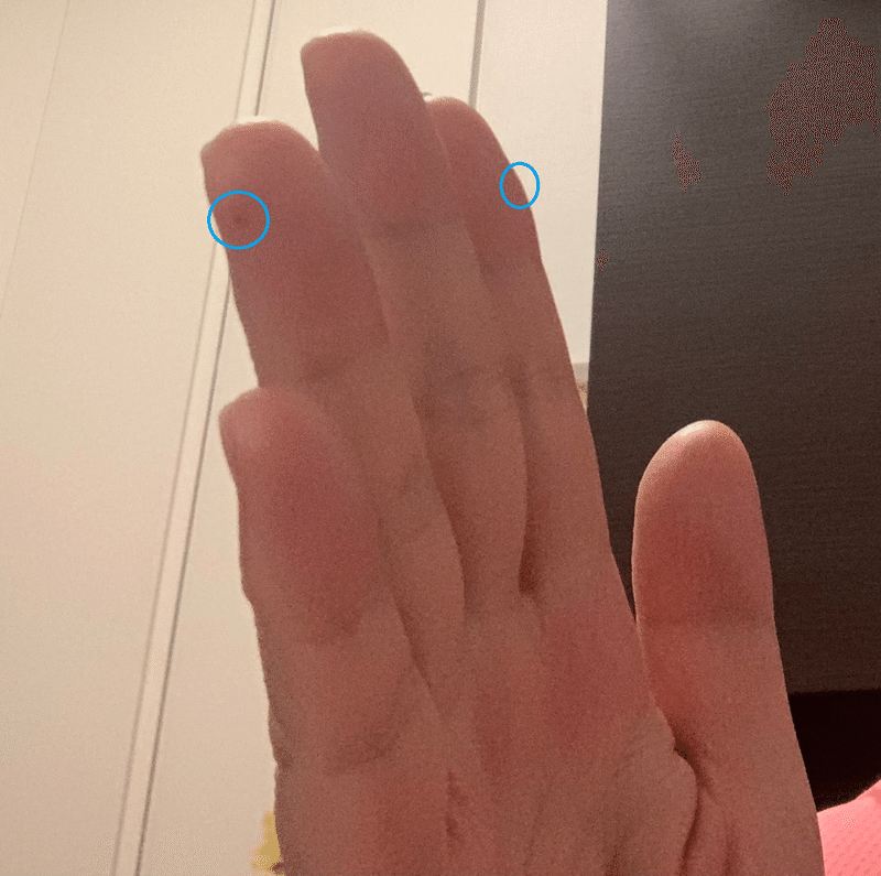 気づいたら手の指に コジミ Note 気づいたら手の指に コジミ Note