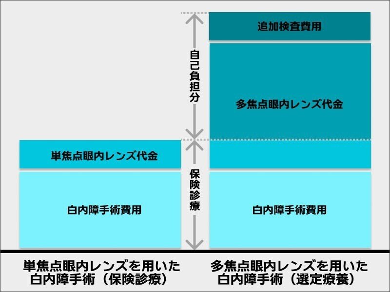 白内障選定医療