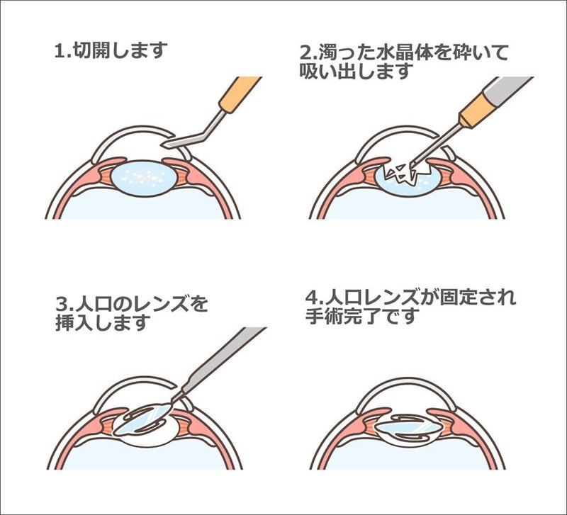 画像11