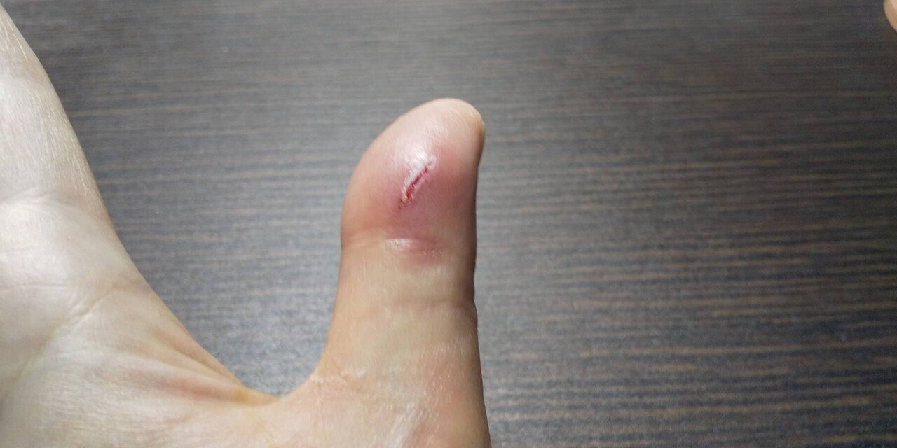 飼い犬に手を噛まれた話 アンモナイト鈴木 Note 飼い犬に手を噛まれた話 アンモナイト鈴木 Note