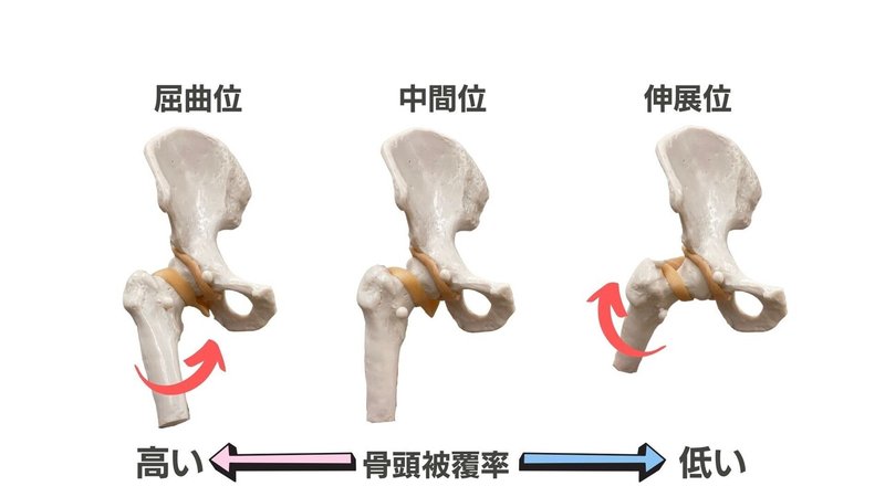 大腿骨頭被覆率屈曲伸展