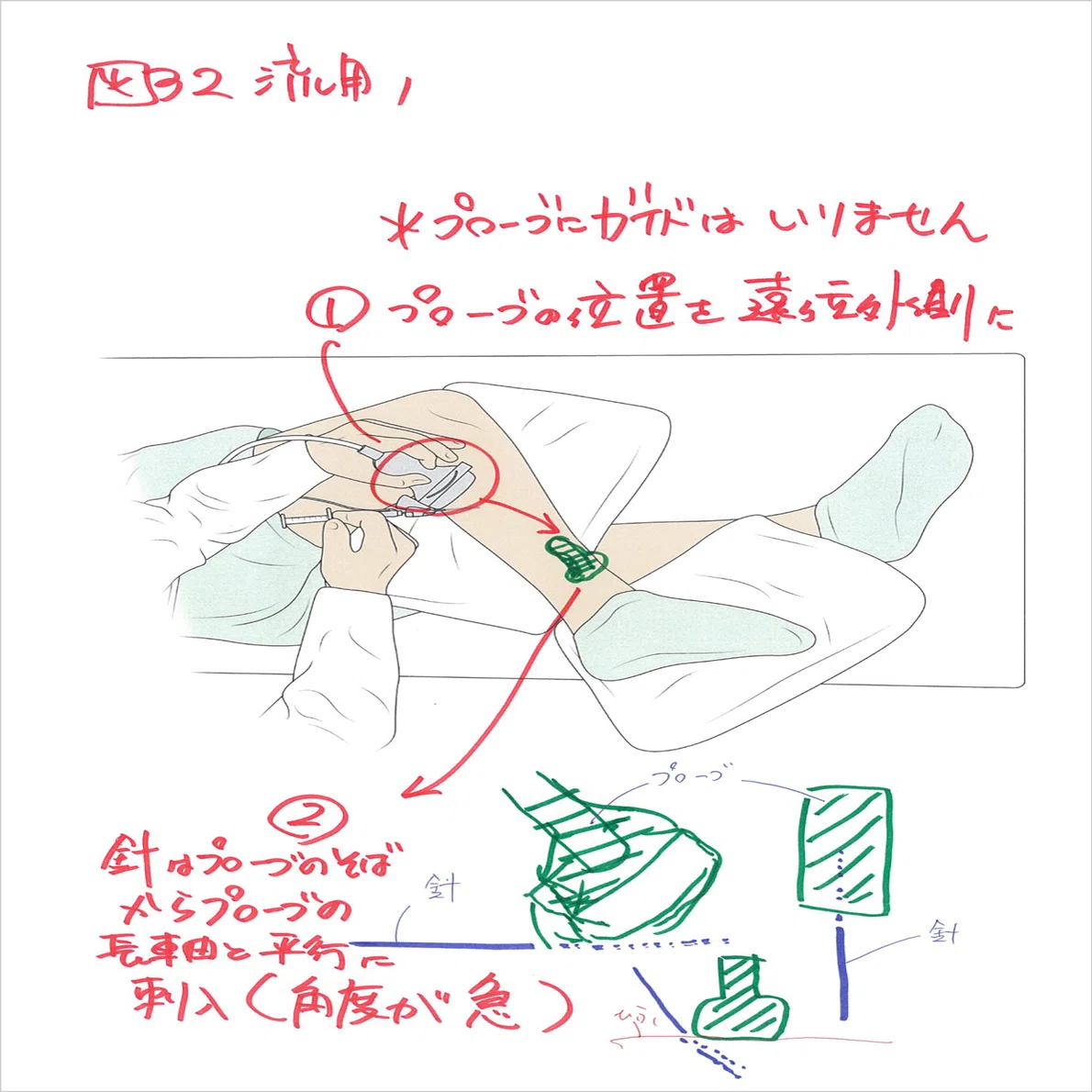 ゼロからマスター 脊椎超音波ガイド下ブロック』｜メジカルビュー社