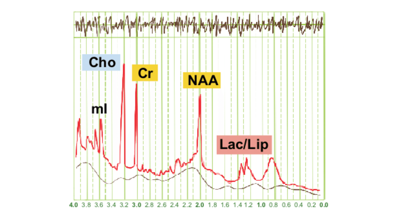 MRS｜MRI認定試験対策ノート