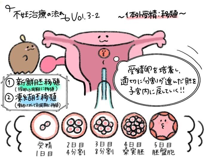 不妊治療の流れ④