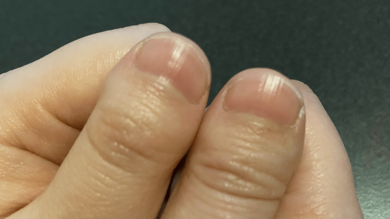 こんなことで1万人に1人に選ばれても 親指がコンプレックス ふーふーちゃんねる の嫁です Note