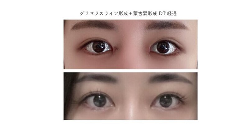グラマラスライン形成 の新着タグ記事一覧 Note つくる つながる とどける グラマラスライン形成 の新着タグ記事一覧 Note つくる つながる とどける