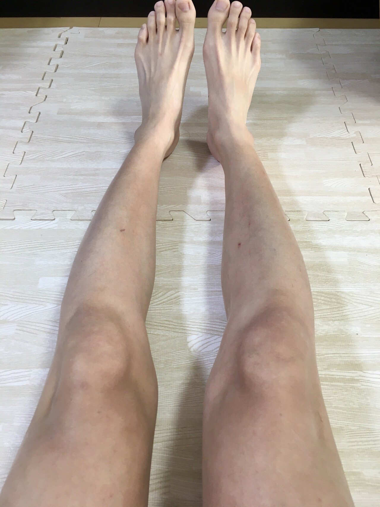 すね毛を除毛すると 卓球 サウナにどう影響するのか 照井雄太 卓球とサウナが好き Note すね毛を除毛すると 卓球 サウナにどう影響するのか 照井雄太 卓球とサウナが好き Note