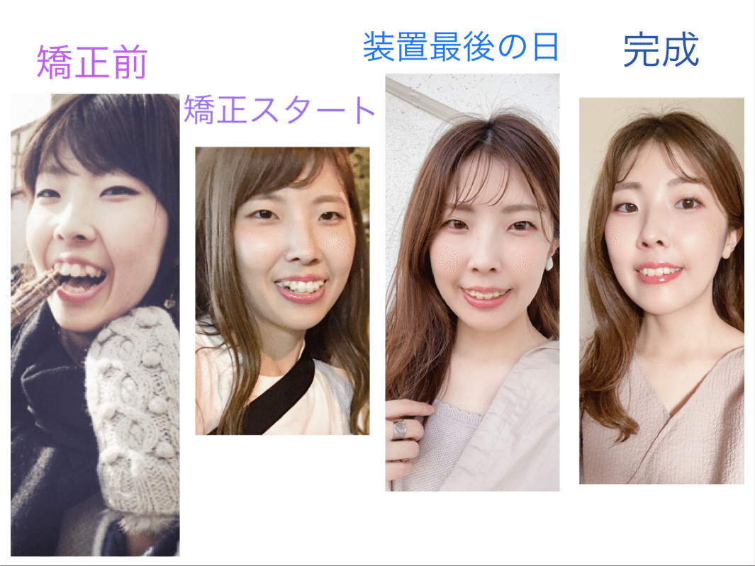歯並びがお顔の印象を左右する きゃな 顔タイプ診断 Amoca 大阪 京都 奈良 Note