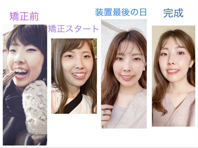 歯並びがお顔の印象を左右する きゃな 顔タイプ診断 Amoca 大阪 京都 奈良 Note