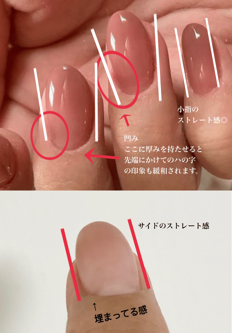 大好評カウンセリング企画 企画史上最難関 ペンダコ対策の巻 Maonailofficial Note