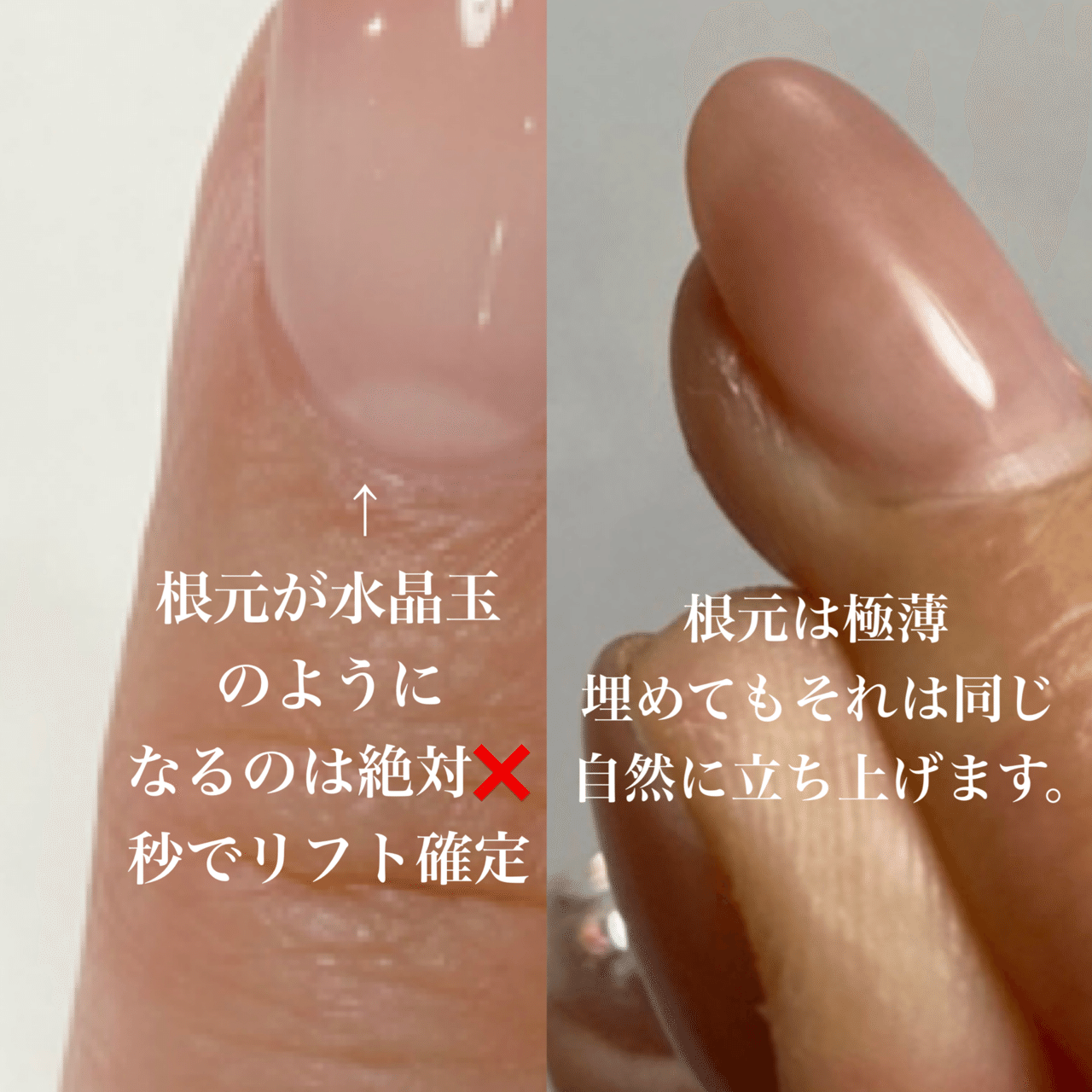 大好評カウンセリング企画 企画史上最難関 ペンダコ対策の巻 Maonailofficial Note