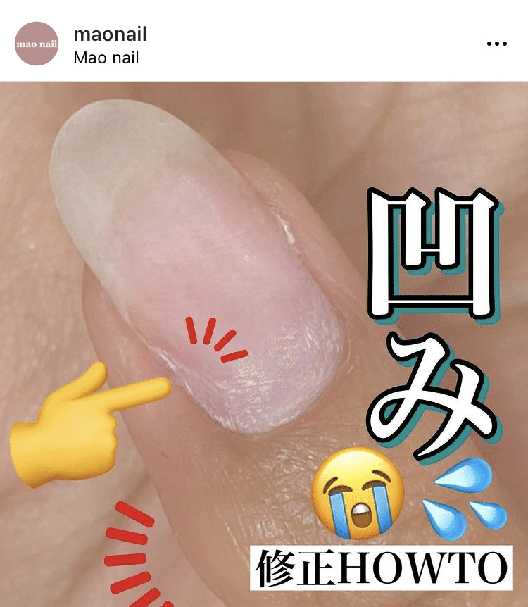 大好評カウンセリング企画 企画史上最難関 ペンダコ対策の巻 Maonailofficial Note 大好評カウンセリング企画 企画史上最難関 ペンダコ対策の巻 Maonailofficial Note