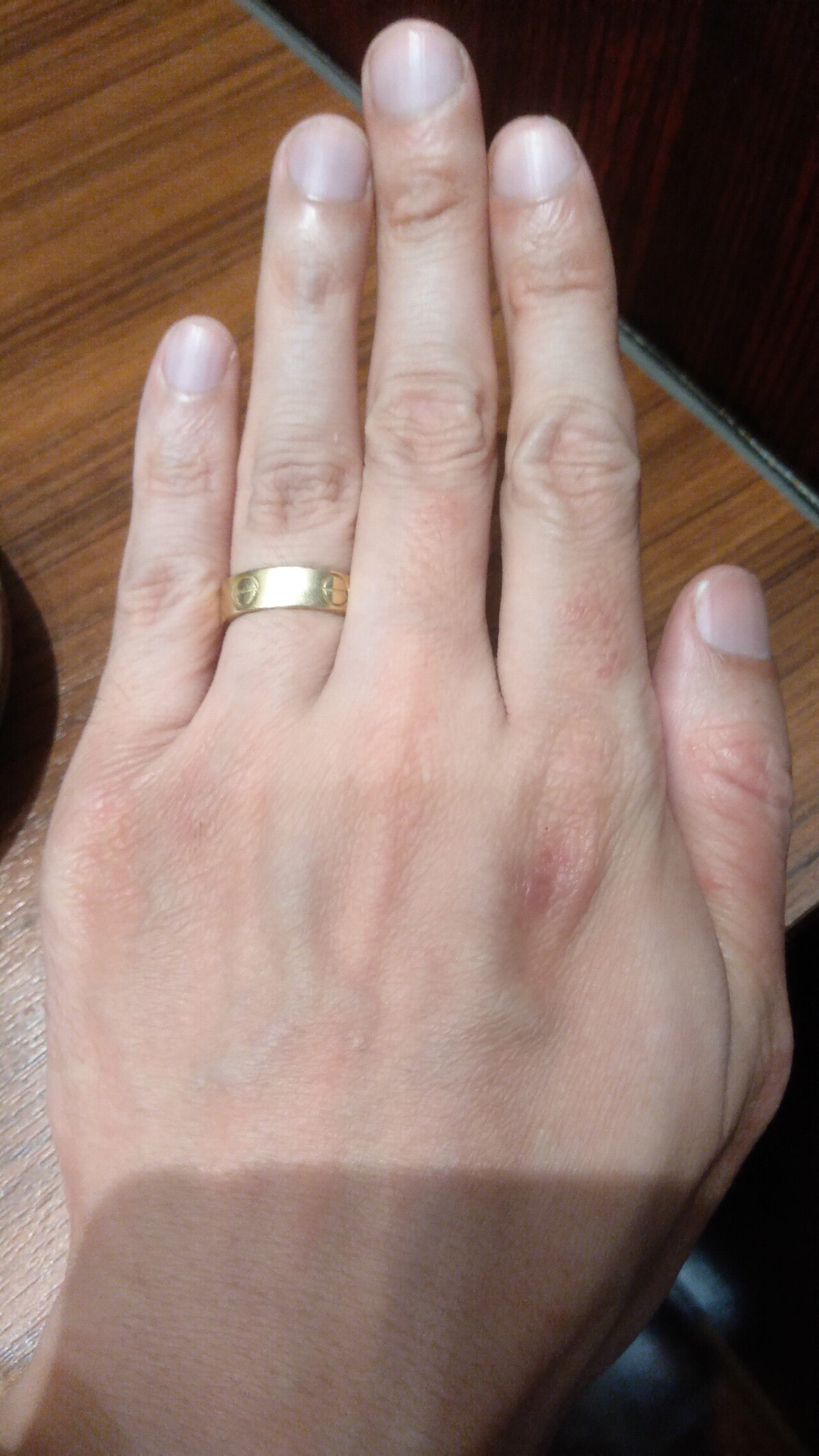 おはようございます 僕の結婚指輪のサイズは7号です 細いほうですか 僕は身長177cm体重72kgのメタボオッサンです ドゥギー 時 を操る経理マン 奥様はタイ 人 大泉洋に俺はなる Note おはようございます 僕の結婚指輪のサイズは7号です 細いほうですか 僕は身長177cm体重72kgのメタボオッサンです ドゥギー 時 を操る経理マン 奥様はタイ 人 大泉洋に俺はなる Note