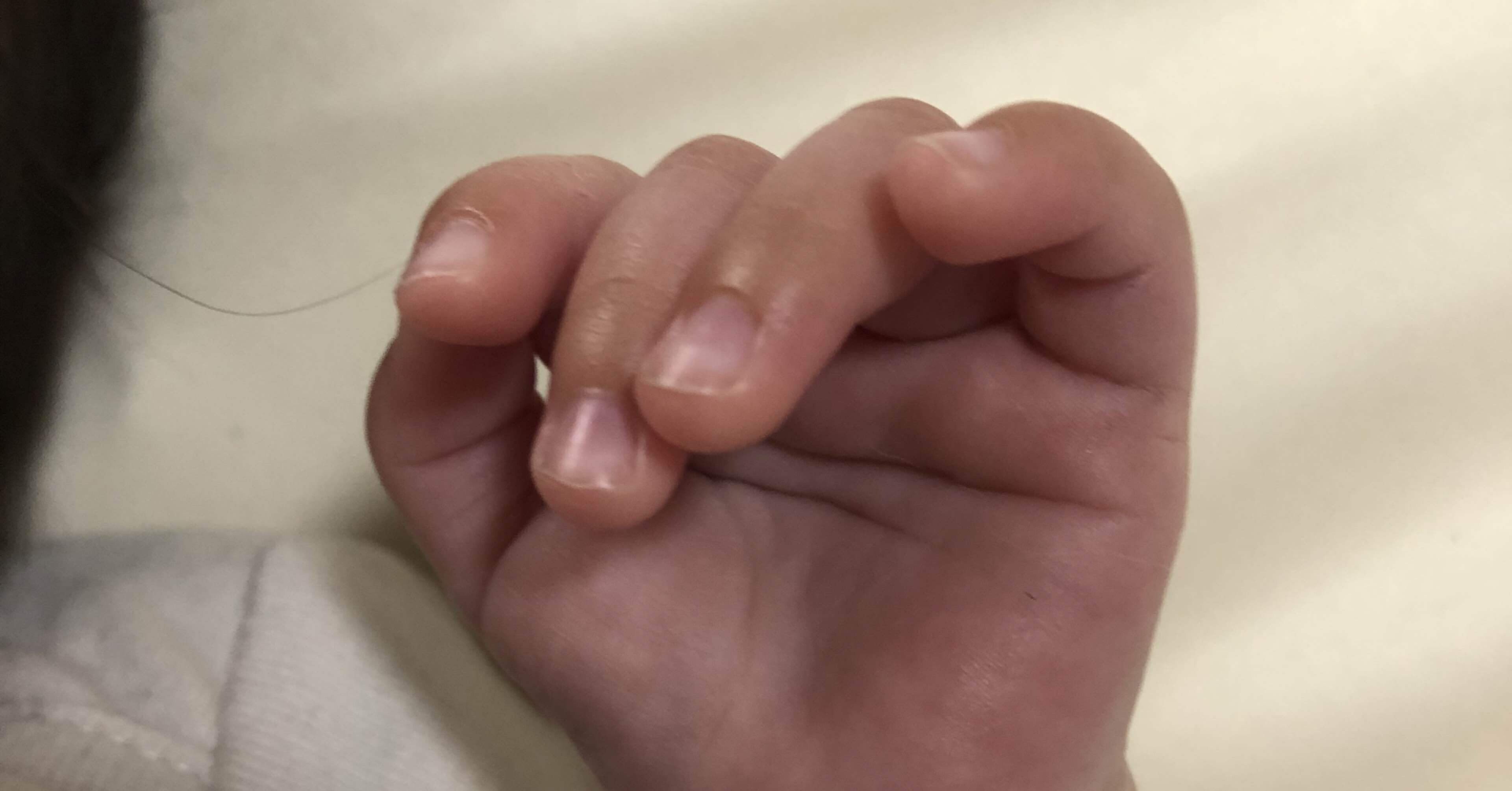 生後21日 授乳で悩みもつきません コロナで里帰りもできずワンオペのため誰にも頼る事ができない状況です 過飲症候群 妊娠中から子育てを学べる助産院 つみき助産院 Note