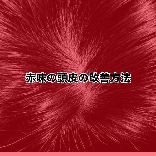 頭皮の色で解るあなたの頭皮レベル 赤味のある頭皮編 宇都宮ヘッドスパ スパニスト美容師けいすけ Note