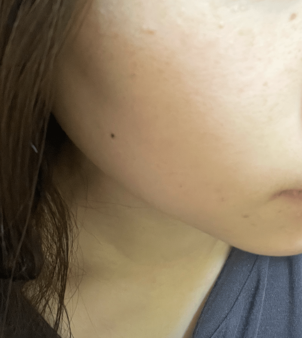 Acpサイトアプデの裏側で行われた 忙しい肌は時計遺伝美容液で救えるのか 検証レポ アジャイル コスメティクス プロジェクト Note