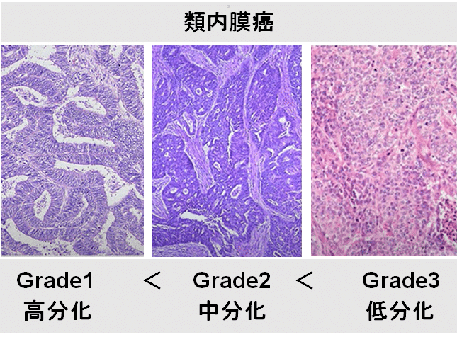 ロボット支援下 腹腔鏡下子宮悪性腫瘍手術 -work.07-|Yama ロボット支援下 腹腔鏡下子宮悪性腫瘍手術 -work.07-|Yama