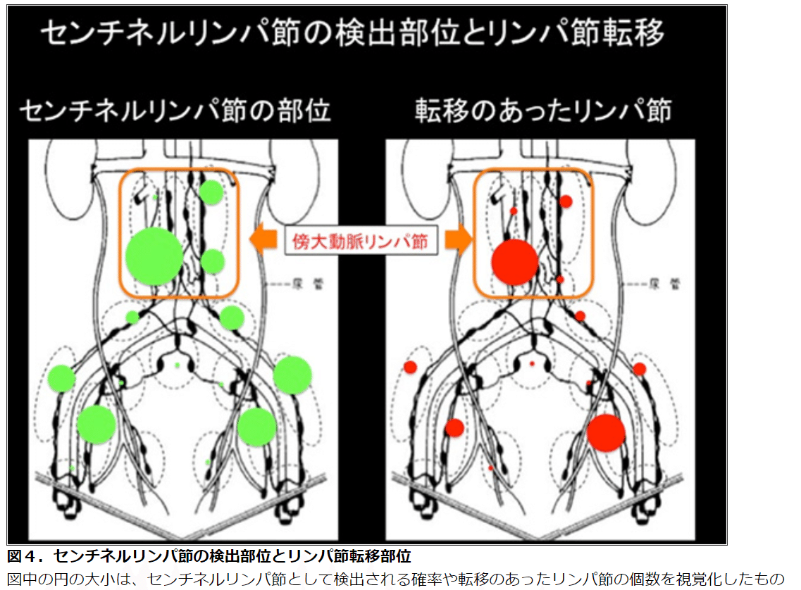 ロボット支援下 腹腔鏡下子宮悪性腫瘍手術 -work.07-｜Yama