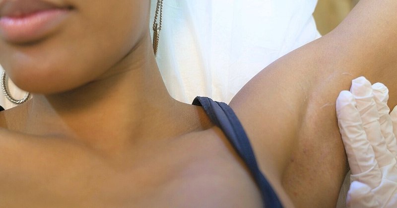 脇毛脱毛はやっておいたほうが良い 脱毛開始後に気になる部位 マツタニアスカ Note