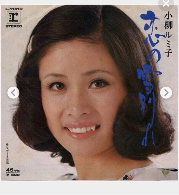 八重歯ってカワイイ 歯のブログ 八重歯ってカワイイ 歯のブログ
