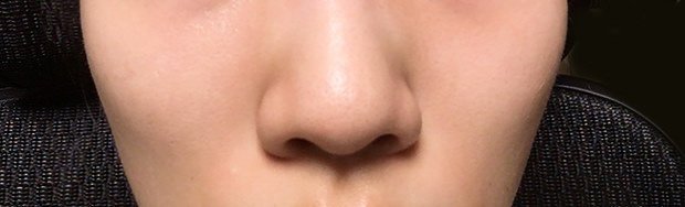 写真付き体験談 Bnls注射を鼻に打って来たよ ひまめるこ Note 写真付き体験談 Bnls注射を鼻に打って来たよ ひまめるこ Note