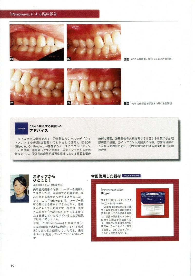 患者満足度が証す最先端の歯周治療法(4)
